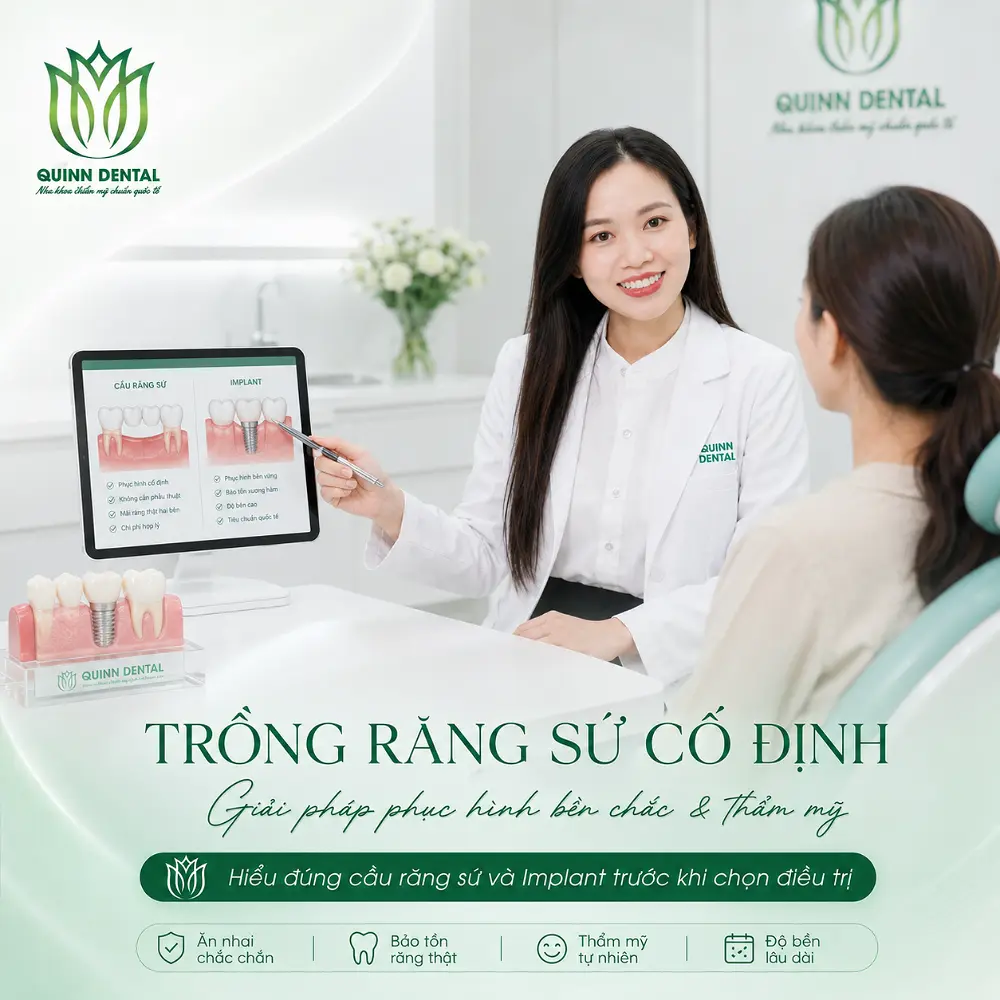 Bác sĩ Quinn Dental tư vấn trồng răng sứ cố định và so sánh cầu răng sứ với mão sứ trên Implant cho người mất răng