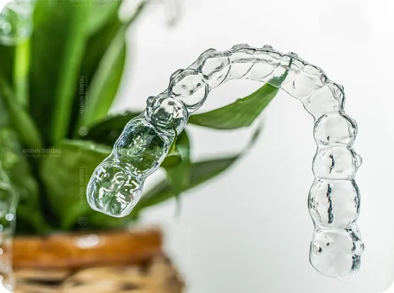 Niềng răng chỉnh nha tại Nha Khoa Quinn Dental Cầu Giấy
