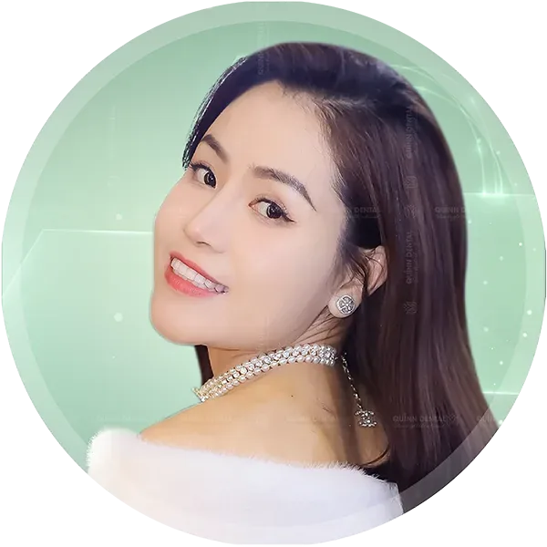Răng sứ Lacon Plus Mỹ tại Nha Khoa Quinn Dental