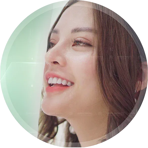 Răng sứ Lava Plus Mỹ tại Nha Khoa Quinn Dental