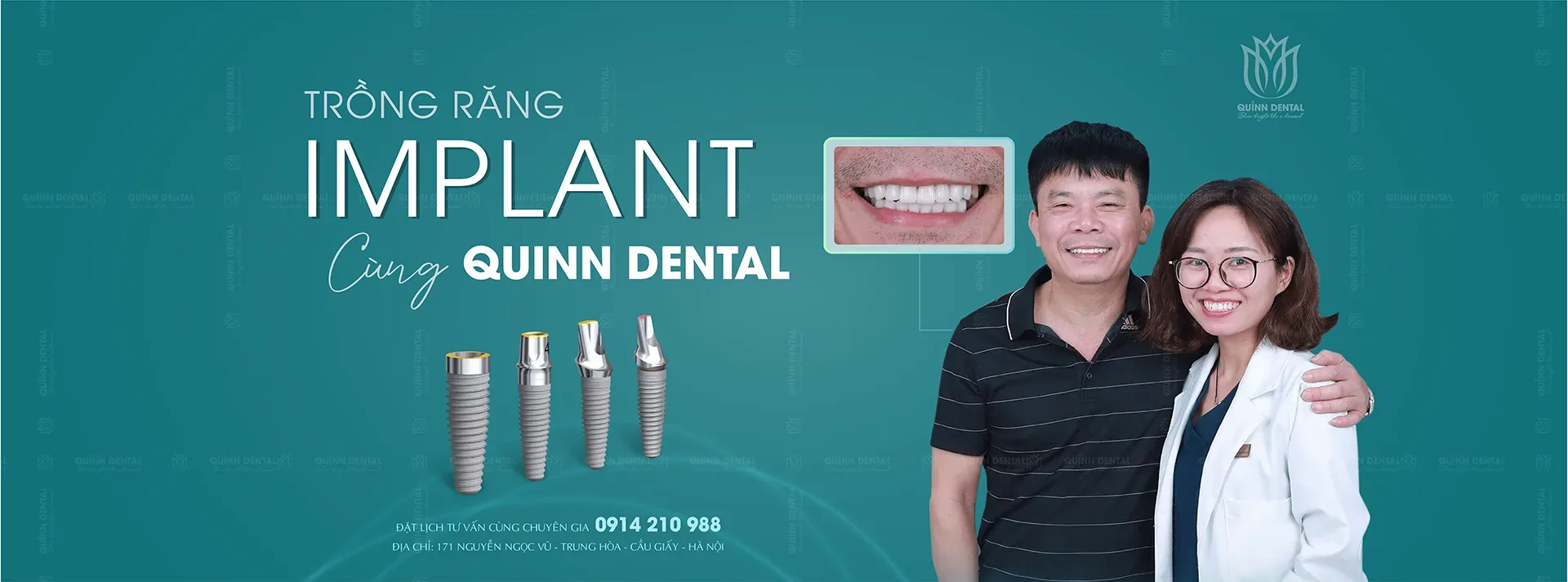 Banner dịch vụ nha khoa Quinn Dental 171 Nguyễn Ngọc Vũ Cầu Giấy